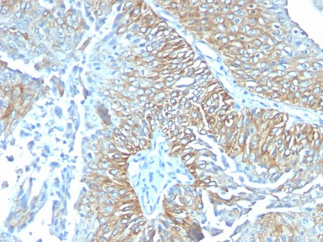 TRIM29 (Lung Squamous Cell Carcinoma Marker) Antibody in Immunohistochemistry (Paraffin) (IHC (P))