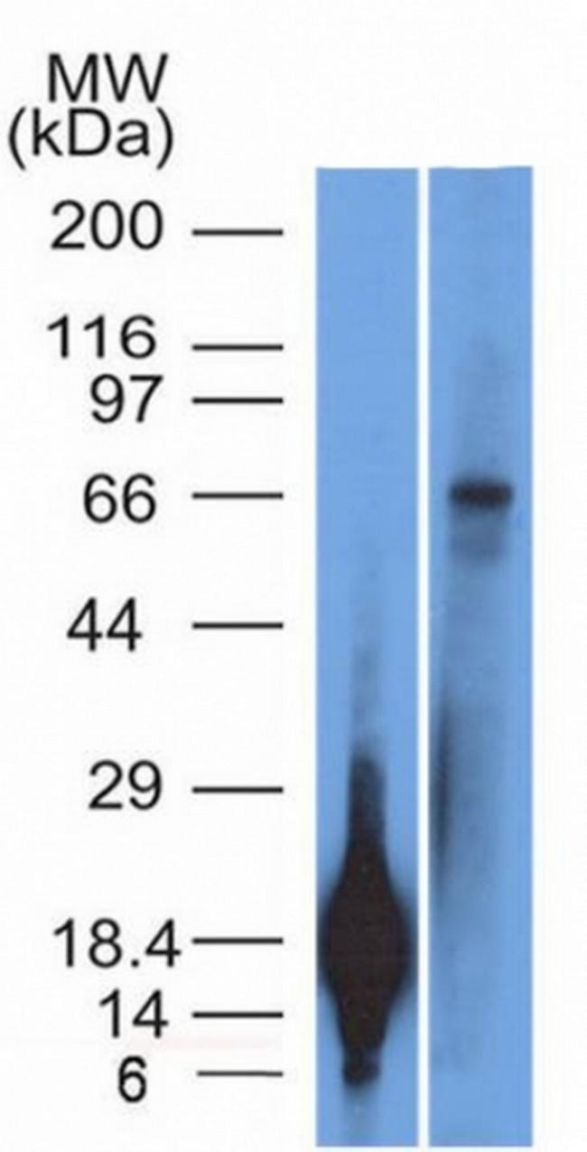 TRIM29 (Lung Squamous Cell Carcinoma Marker) Antibody in Western Blot (WB)