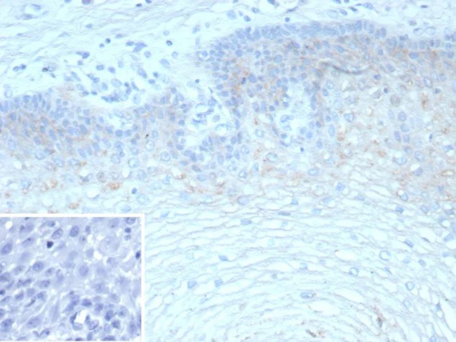 TRIM29 (Lung Squamous Cell Carcinoma Marker) Antibody in Immunohistochemistry (Paraffin) (IHC (P))