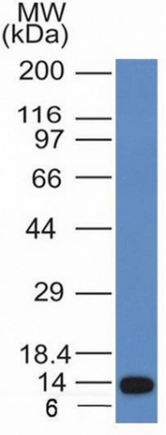 ALK (Anaplastic Lymphoma Kinase)/CD246 Antibody in Western Blot (WB)