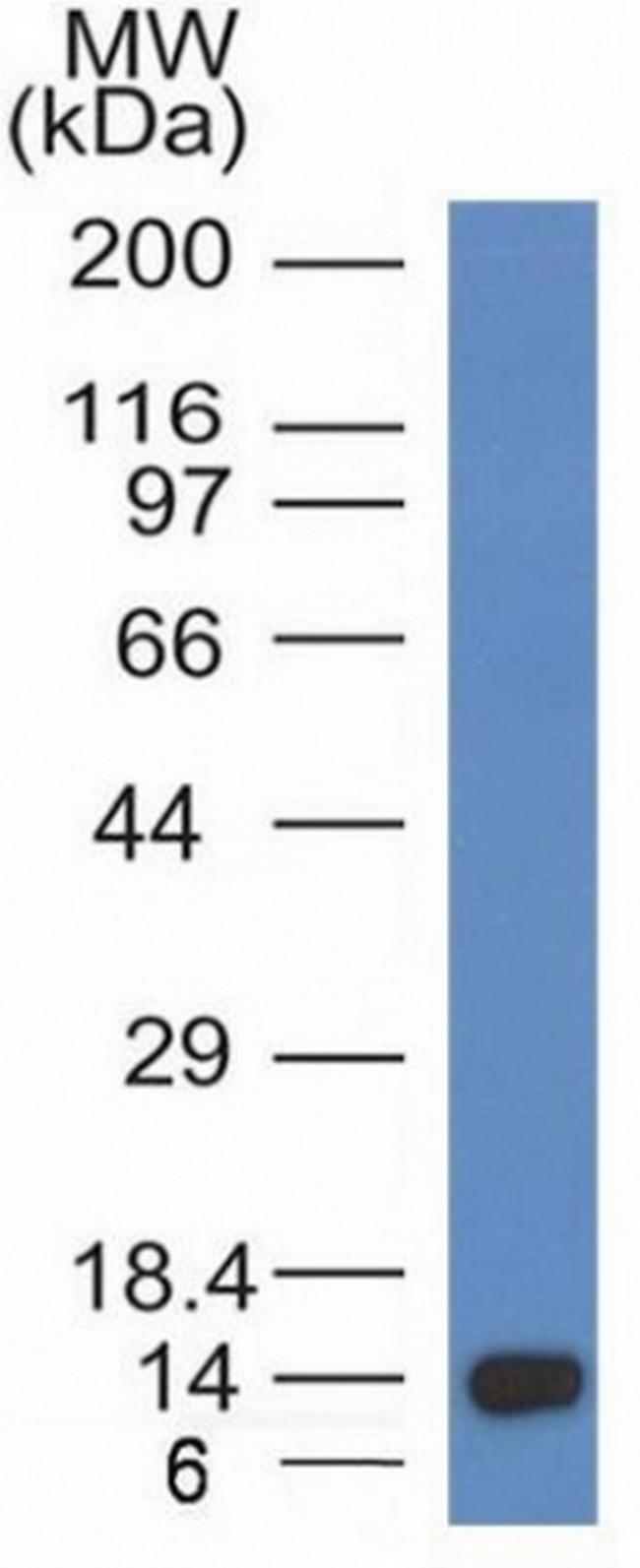 ALK (Anaplastic Lymphoma Kinase)/CD246 Antibody in Western Blot (WB)