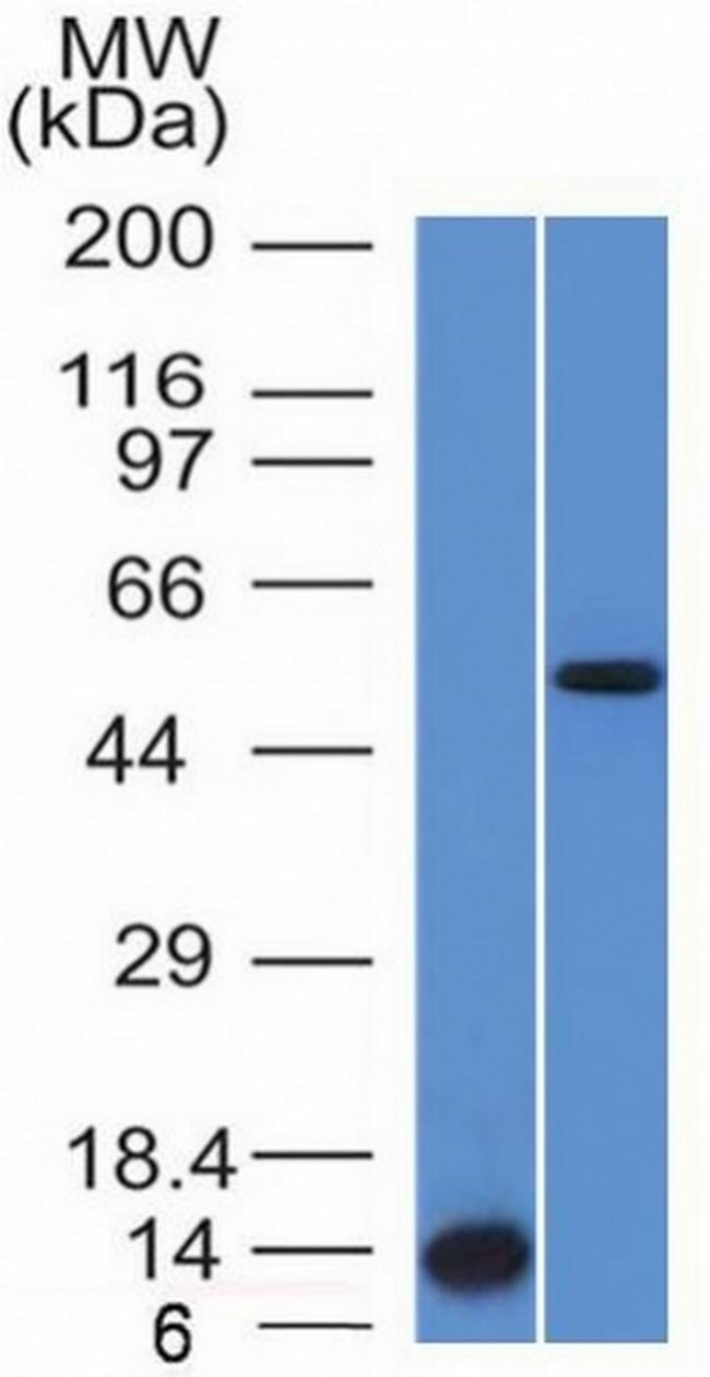 ALK (Anaplastic Lymphoma Kinase)/CD246 Antibody in Western Blot (WB)