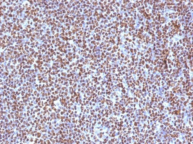 ALK (Anaplastic Lymphoma Kinase)/CD246 Antibody in Immunohistochemistry (Paraffin) (IHC (P))