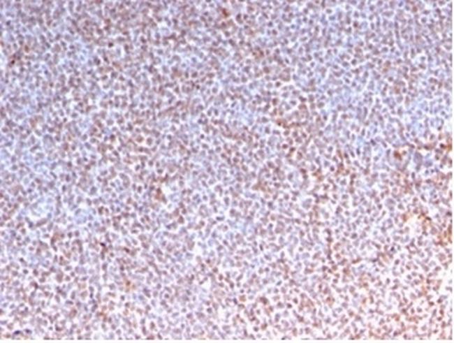 ALK (Anaplastic Lymphoma Kinase)/CD246 Antibody in Immunohistochemistry (Paraffin) (IHC (P))