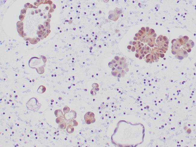 ALK (Anaplastic Lymphoma Kinase)/CD246 Antibody in Immunohistochemistry (Paraffin) (IHC (P))