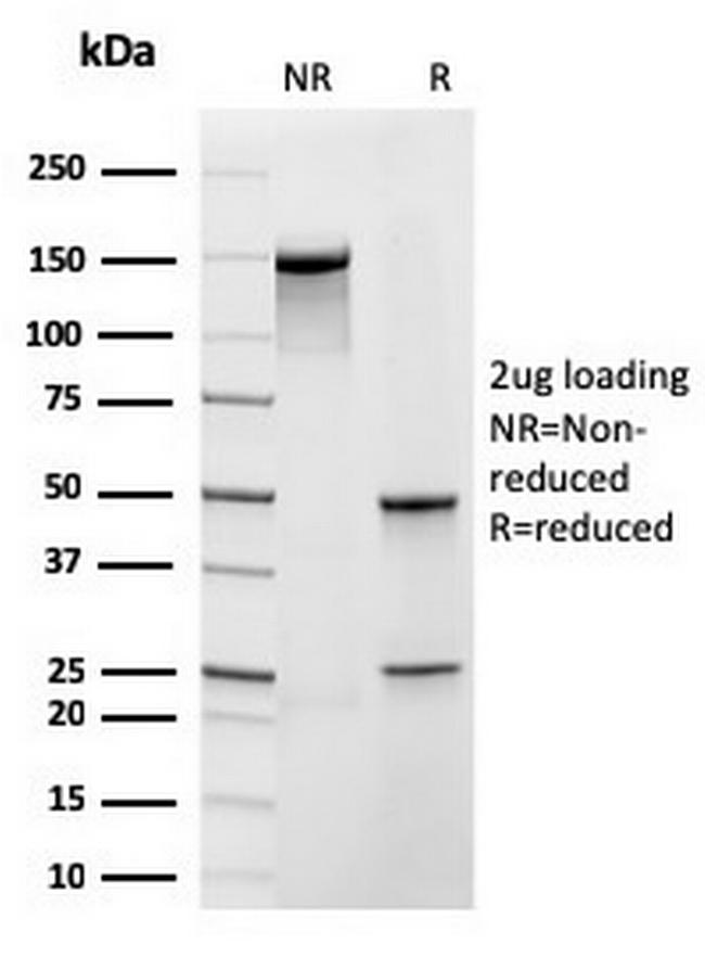 Frataxin (Mitochondrial Marker) Antibody in SDS-PAGE (SDS-PAGE)