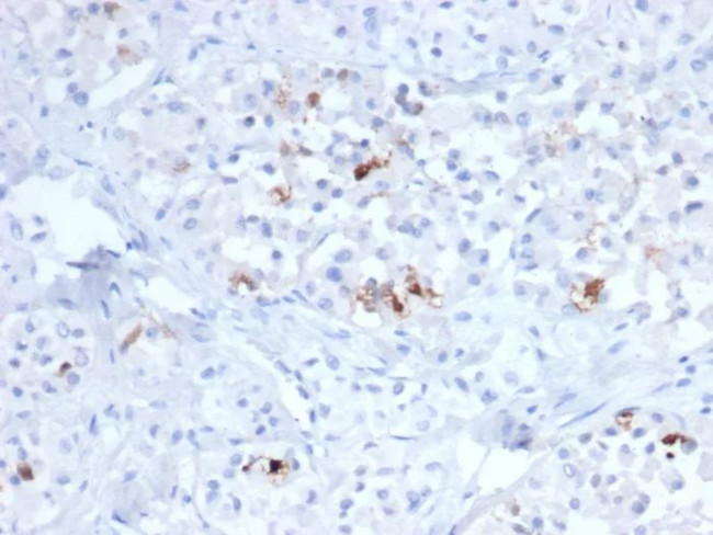 FSH-beta (Follicle Stimulating Hormone-beta) Antibody in Immunohistochemistry (Paraffin) (IHC (P))