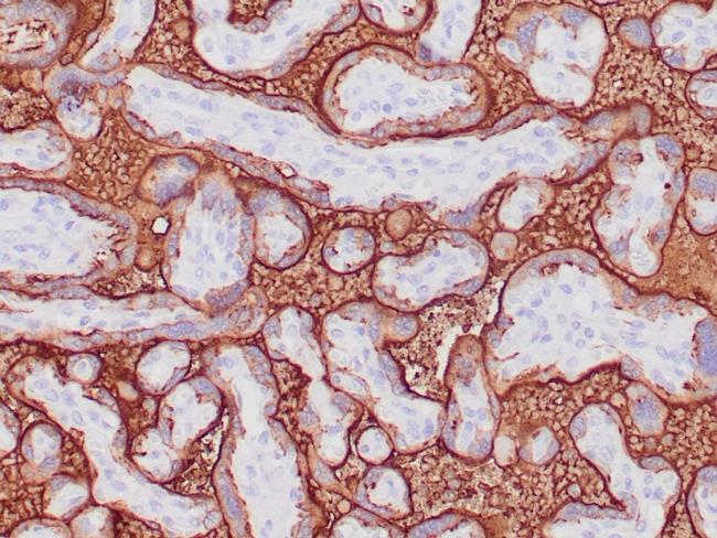 Alkaline Phosphatase (Placental)/PLAP (Germ Cell Tumor Marker) Antibody in Immunohistochemistry (Paraffin) (IHC (P))