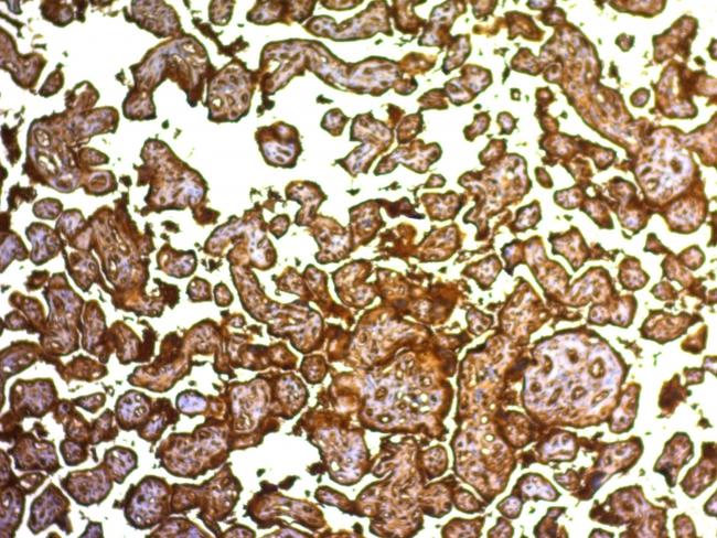 Placental Alkaline Phosphatase (PLAP) (Germ Cell Tumor Marker) Antibody in Immunohistochemistry (Paraffin) (IHC (P))