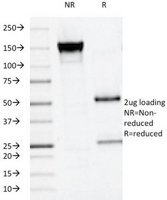 Alkaline Phosphatase (Placental)/PLAP (Germ Cell Tumor Marker) Antibody in SDS-PAGE (SDS-PAGE)