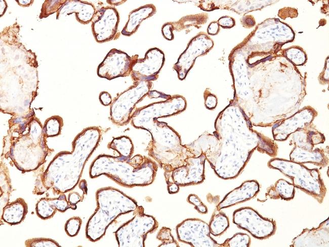 Alkaline Phosphatase (Placental)/PLAP (Germ Cell Tumor Marker) Antibody in Immunohistochemistry (Paraffin) (IHC (P))