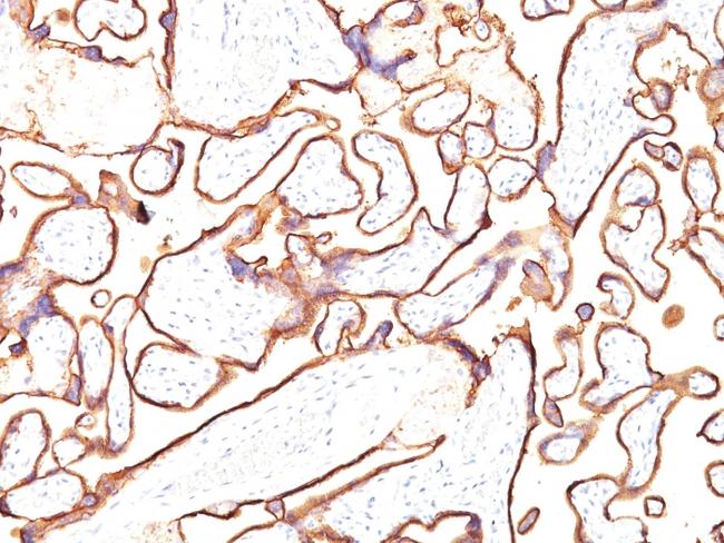 Alkaline Phosphatase (Placental)/PLAP (Germ Cell Tumor Marker) Antibody in Immunohistochemistry (Paraffin) (IHC (P))