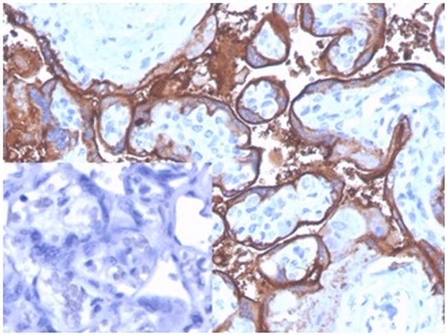 Alkaline Phosphatase (Placental)/PLAP Antibody in Immunohistochemistry (Paraffin) (IHC (P))