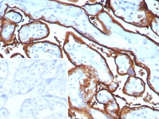 Alkaline Phosphatase (Placental)/PLAP (Germ Cell Tumor Marker) Antibody in Immunohistochemistry (Paraffin) (IHC (P))