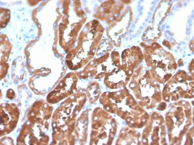 Ferritin, Light Chain (Node-Negative Breast Tumor Prognostic Marker) Antibody in Immunohistochemistry (Paraffin) (IHC (P))