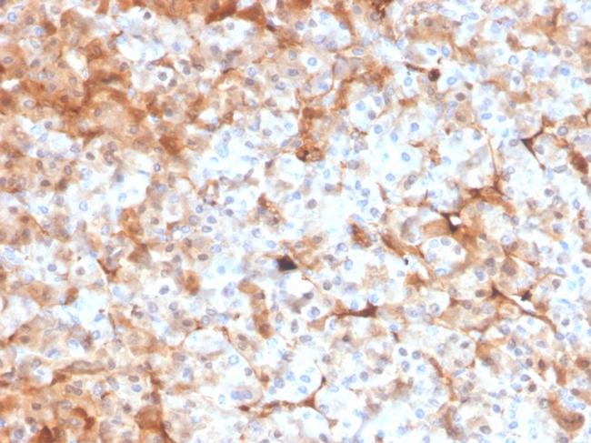 Ferritin, Light Chain Antibody in Immunohistochemistry (Paraffin) (IHC (P))