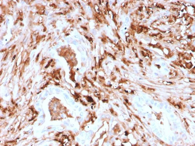 Ferritin, Light Chain (Node-Negative Breast Tumor Prognostic Marker) Antibody in Immunohistochemistry (Paraffin) (IHC (P))