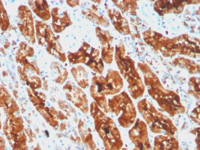 Ferritin, Light Chain (Node-Negative Breast Tumor Prognostic Marker) Antibody in Immunohistochemistry (Paraffin) (IHC (P))