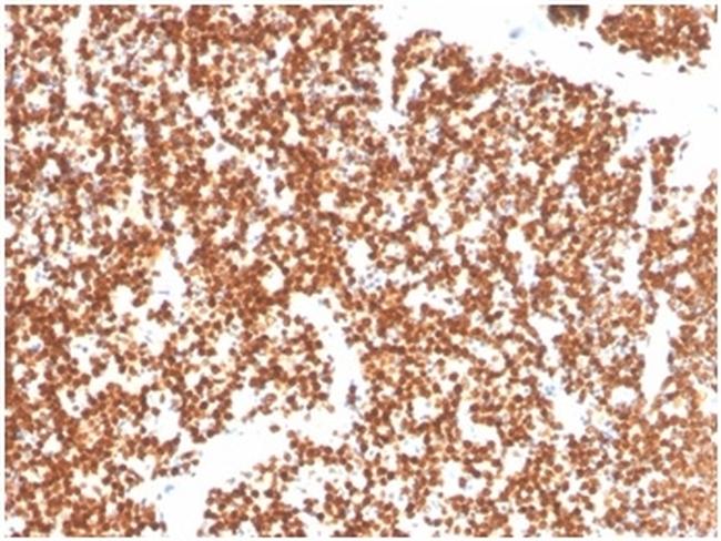 Steroidogenic Factor 1 (SF-1) Antibody in Immunohistochemistry (Paraffin) (IHC (P))