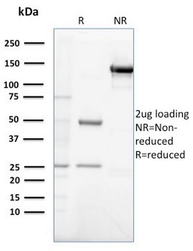 Gastrin Antibody in SDS-PAGE (SDS-PAGE)