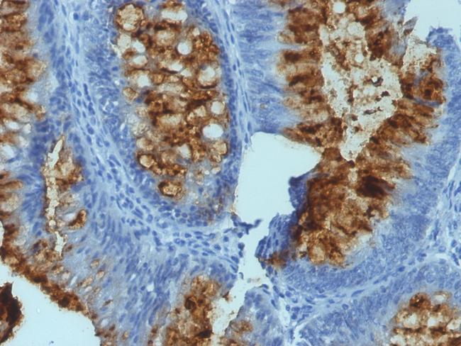 Blood Group Antigen Lewis B Antibody in Immunohistochemistry (Paraffin) (IHC (P))