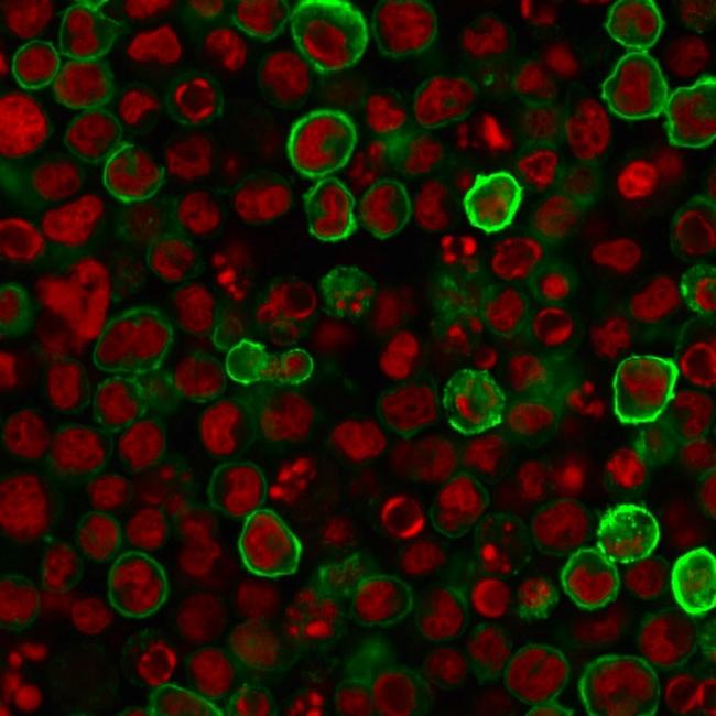 CD15/FUT4 (Reed-Sternberg Cell Marker) Antibody in Immunocytochemistry (ICC/IF)