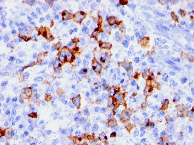 CD15/FUT4 (Reed-Sternberg Cell Marker) Antibody in Immunohistochemistry (Paraffin) (IHC (P))