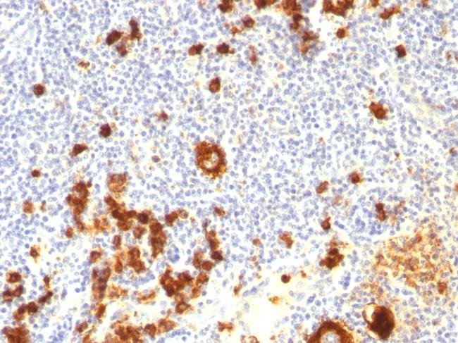 CD15/FUT4 (Reed-Sternberg Cell Marker) Antibody in Immunohistochemistry (Paraffin) (IHC (P))