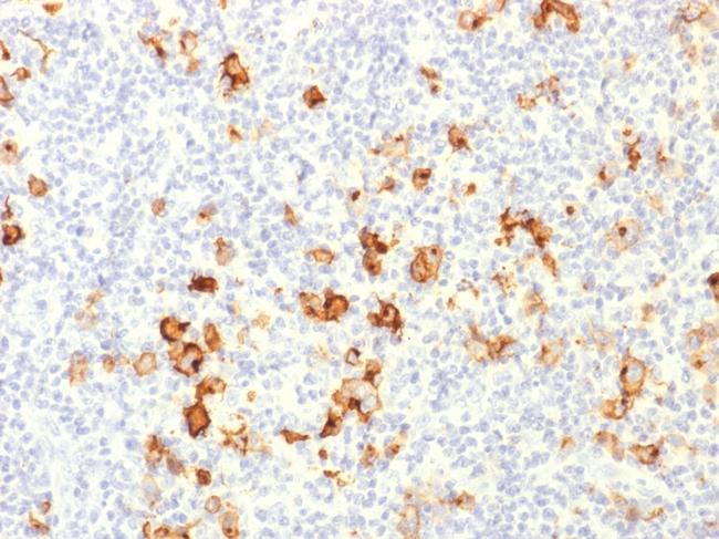 CD15/FUT4 (Reed-Sternberg Cell Marker) Antibody in Immunohistochemistry (Paraffin) (IHC (P))