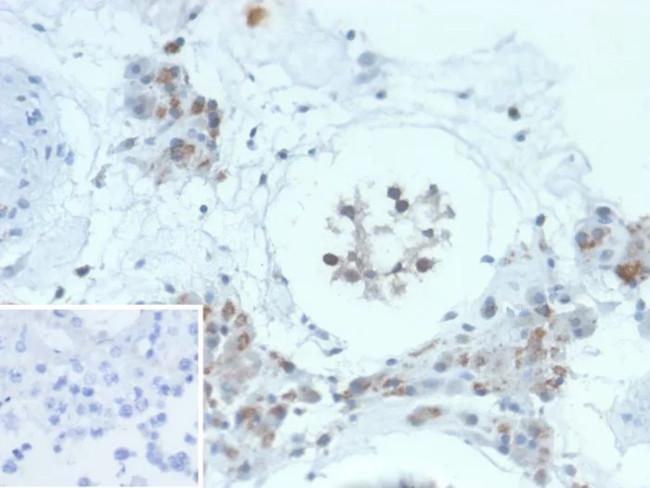 HGAL (Human Germinal Center Associated Lymphoma Marker) Antibody in Immunohistochemistry (Paraffin) (IHC (P))