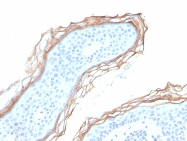 Kallikrein 5 (KLK5) Antibody in Immunohistochemistry (Paraffin) (IHC (P))