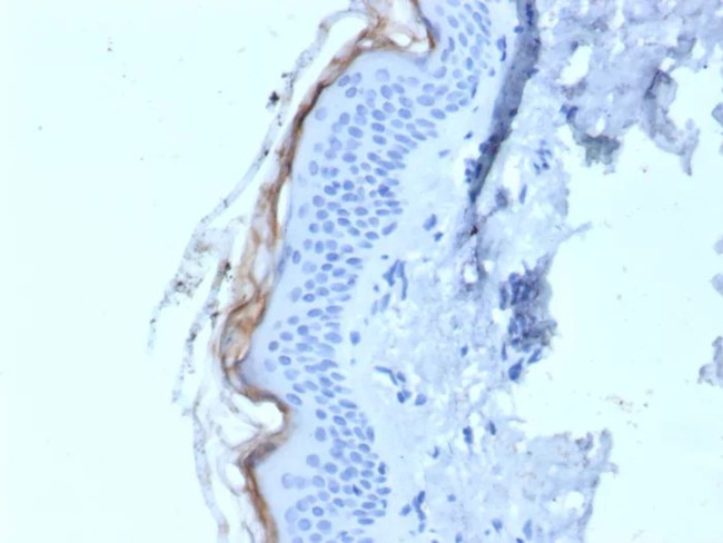 Kallikrein 5 (KLK5) Antibody in Immunohistochemistry (Paraffin) (IHC (P))