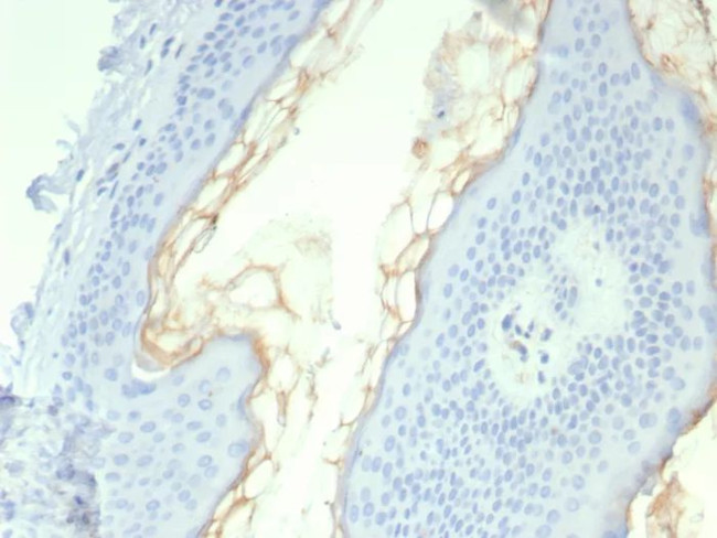 Kallikrein 5 (KLK5) Antibody in Immunohistochemistry (Paraffin) (IHC (P))