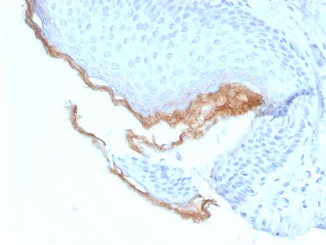 Kallikrein 5 (KLK5) Antibody in Immunohistochemistry (Paraffin) (IHC (P))