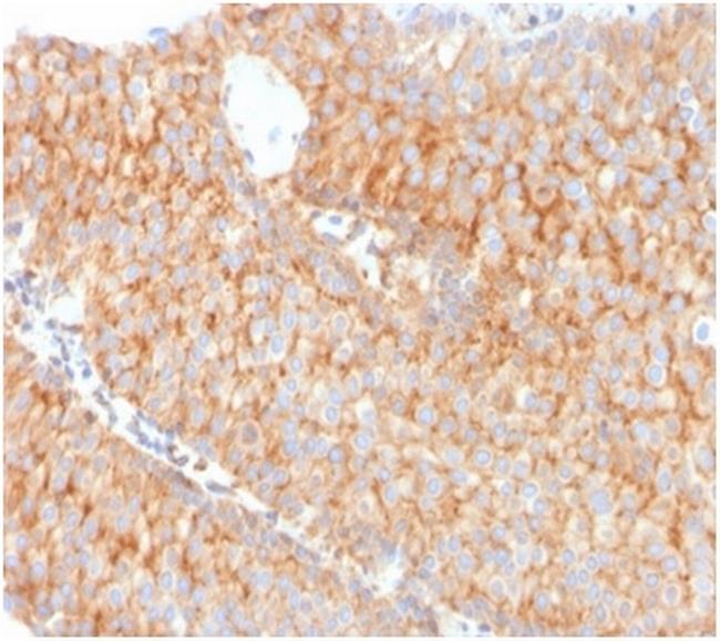 SERBP1/PAI-RBP1 Antibody in Immunohistochemistry (Paraffin) (IHC (P))