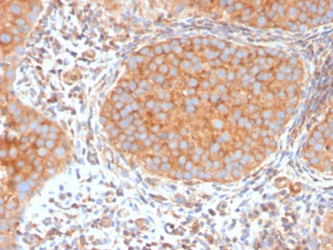 SERBP1/PAI-RBP1 Antibody in Immunohistochemistry (Paraffin) (IHC (P))