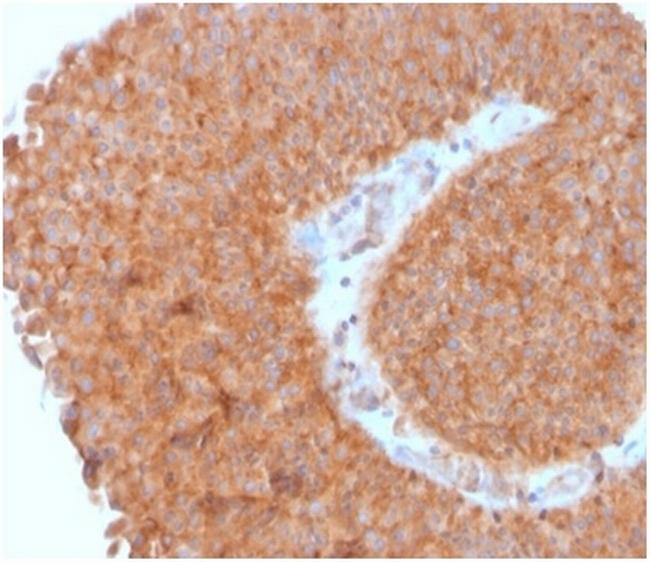 SERBP1/PAI-RBP1 Antibody in Immunohistochemistry (Paraffin) (IHC (P))