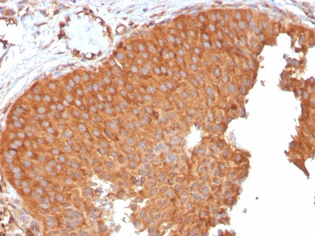 SERBP1/PAI-RBP1 Antibody in Immunohistochemistry (Paraffin) (IHC (P))