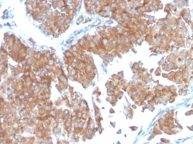 SERBP1/PAI-RBP1 Antibody in Immunohistochemistry (Paraffin) (IHC (P))