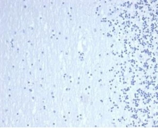 GATA-3 (Center) (Breast and Urothelial Marker) Antibody in Immunohistochemistry (Paraffin) (IHC (P))