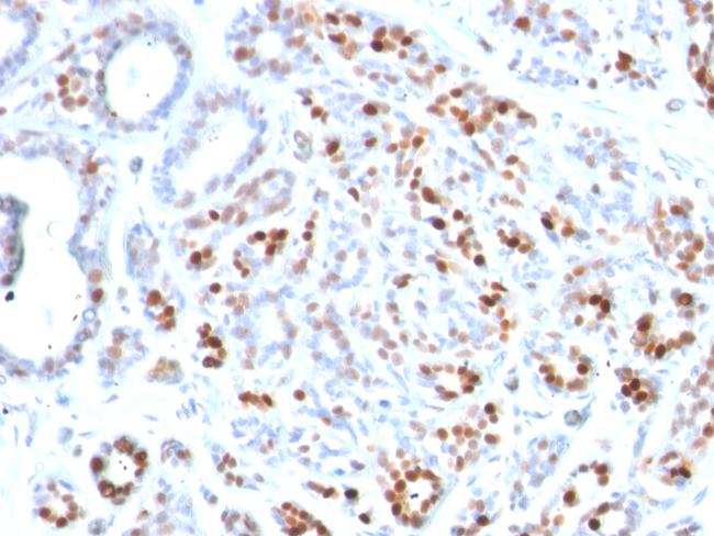 GATA-3 (Breast and Urothelial Marker) Antibody in Immunohistochemistry (Paraffin) (IHC (P))