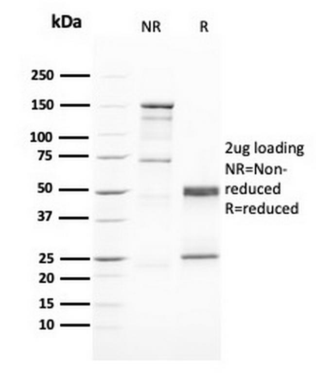 GATA-3 (Breast and Urothelial Marker) Antibody in SDS-PAGE (SDS-PAGE)