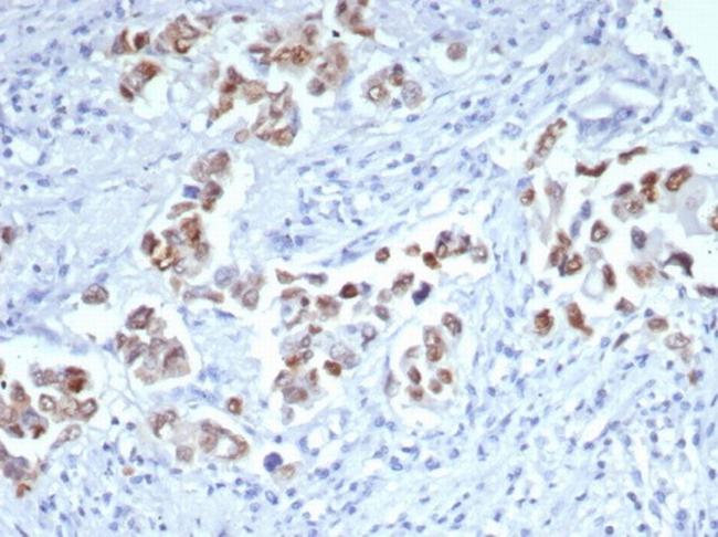 GATA-3 (Breast and Urothelial Marker) Antibody in Immunohistochemistry (Paraffin) (IHC (P))