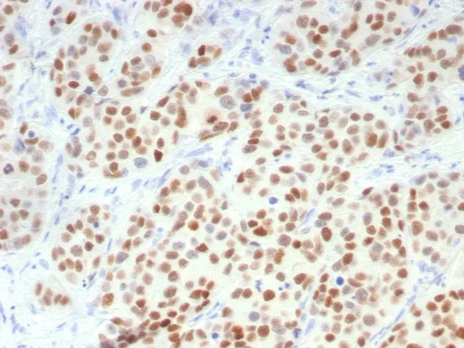 GATA-3 (Breast and Urothelial Marker) Antibody in Immunohistochemistry (Paraffin) (IHC (P))