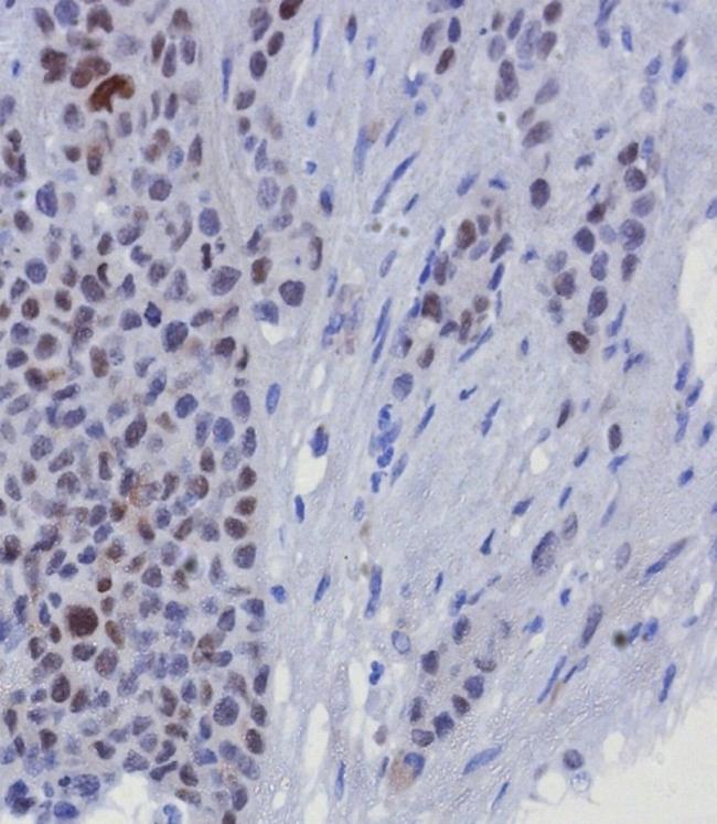 GATA-3 (Breast and Urothelial Marker) Antibody in Immunohistochemistry (Paraffin) (IHC (P))