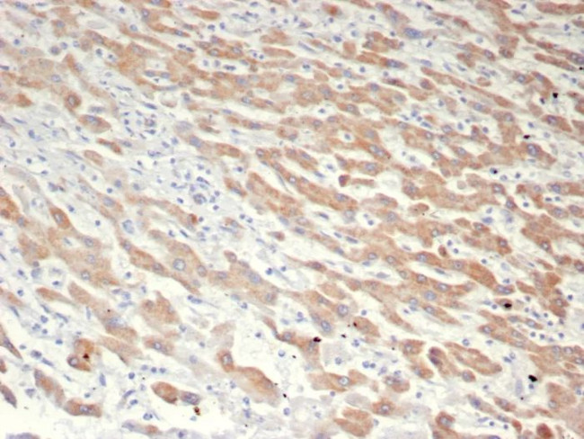 GCHFR Antibody in Immunohistochemistry (Paraffin) (IHC (P))