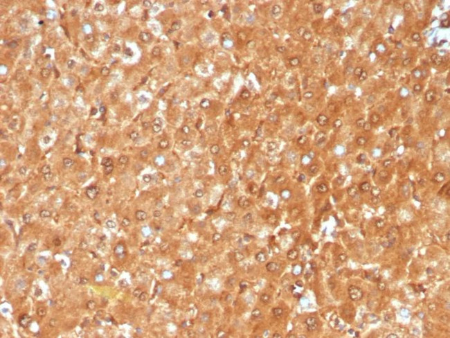 GCHFR Antibody in Immunohistochemistry (Paraffin) (IHC (P))