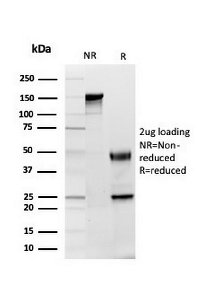 GDF8 (Growth Differentiation Factor 8)/Myostatin Antibody in SDS-PAGE (SDS-PAGE)