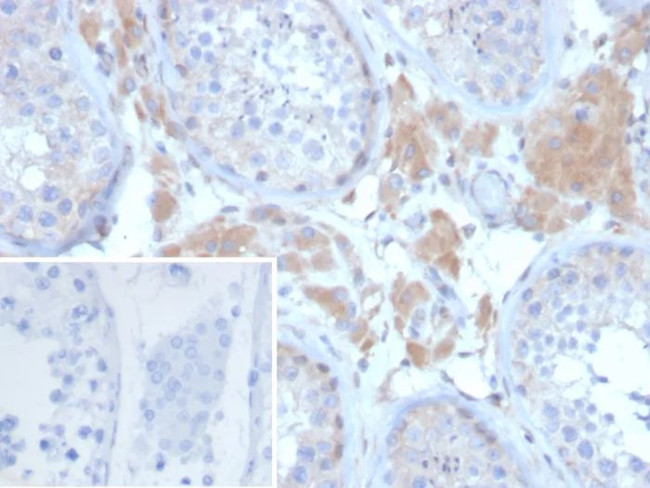 GDF9 (Growth Differentiation Factor 9) Antibody in Immunohistochemistry (Paraffin) (IHC (P))