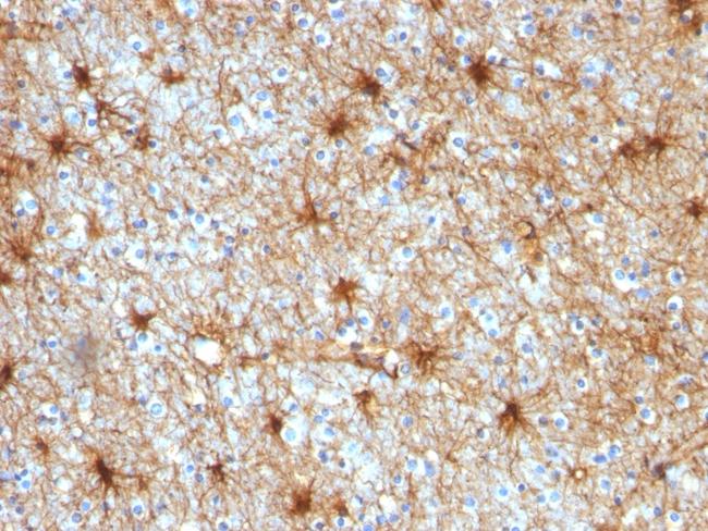 GFAP (Astrocyte and Neural Stem Cell Marker) Antibody in Immunohistochemistry (Paraffin) (IHC (P))